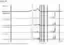 Fig. 77 - SPONTANEOUS RESPIRATORY BIOMATERIAL FOR TISSUE ENGINEERING