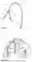 Fig. 02 - DIALYSIS CATHETER CLEARANCE DEVICE AND ASSOCIATED METHOD