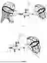 Fig. 04 - DEVICE FOR SPEECH THERAPY, ADMINISTRATION OF INHALATION MEDICATION AND FOR TREATMENT OF OTITIS, SINUSITIS AND BAROTRAUMA