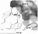 Fig. 05 - PAC1 ANTIBODIES AND USES THEREOF