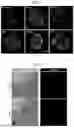 Fig. 07 - INFECTED CELL CULTURES