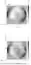 Fig. 05 - System and method for detecting a defect in a specimen