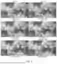 Fig. 07 - CONVOLUTION AND TRANSFORMER BASED COMPRESSIVE SENSING