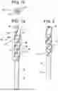 Fig. 02 - Method of drilling holes in bones and harvesting bone fragments for bone grafting