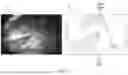 Fig. 06 - GENERATING AUGMENTED VISUALIZATIONS OF SURGICAL SITES USING SEMANTIC SURGICAL REPRESENTATIONS