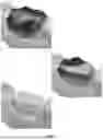 Fig. 02 - SYSTEM AND METHOD FOR AUGMENTED INTELLIGENCE IN GUIDED DENTAL SURGERY