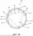 Fig. 08 - METHODS FOR IMPROVED PROSTHETIC HEART VALVE WITH LEAFLET SHELVING