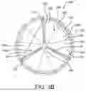 Fig. 09 - METHODS FOR IMPROVED PROSTHETIC HEART VALVE WITH LEAFLET SHELVING