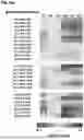 Fig. 08 - Lipid Abnormalities and Association with Atopic Allergic Diseases
