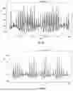 Fig. 03 - DEVICE FOR TRACKING A PERSON BY USING CONTEXTUALISED ACTIVITY MEASUREMENTS