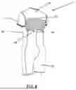 Fig. 09 - One-Piece Bodysuit for Athletic Activities