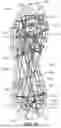 Fig. 14 - ARTICLES OF FOOTWEAR WITH UPPERS COMPRISING A WOUND COMPONENT AND METHODS OF MAKING THE SAME
