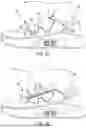 Fig. 07 - AUTOLACING FOOTWEAR HAVING A SLIDING SECURING DEVICE