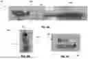 Fig. 09 - BRUSH HEAD FOR AN ORAL HYGIENE DEVICE