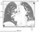 Fig. 05 - USER INTERFACE FOR CONNECTING MODEL STRUCTURES AND ASSOCIATED SYSTEMS AND METHODS
