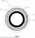 Fig. 09 - CATHETER SYSTEM FOR SEQUENTIAL DEPLOYMENT OF AN EXPANDABLE IMPLANT