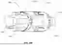 Fig. 40 - CATHETER SYSTEM FOR SEQUENTIAL DEPLOYMENT OF AN EXPANDABLE IMPLANT