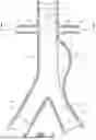 Fig. 02 - APPARATUS AND METHOD OF PLACEMENT OF A GRAFT OR GRAFT SYSTEM