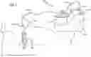 Fig. 02 - Female External Catheters and Methods Thereof