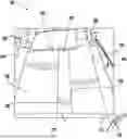 Fig. 01 - METHOD AND DEVICE FOR TURNING AND POSITIONING A PATIENT USING FILLABLE CHAMBERS