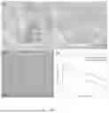 Fig. 02 - Composition for use in the treatment of urinary or faecal incontinence