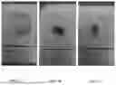 Fig. 08 - METHODS OF TREATING PANCREATIC CANCER