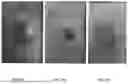 Fig. 09 - METHODS OF TREATING PANCREATIC CANCER