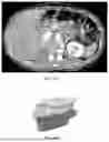 Fig. 49 - METHODS OF TREATING PANCREATIC CANCER