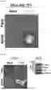 Fig. 22 - METHOD FOR SUPPRESSING CANCER METASTASIS THROUGH ALTERATION OF ADHESION DEPENDENCE OF CANCER CELLS