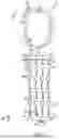 Fig. 02 - Degassed Infusion System for Arterial Infusion