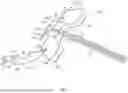 Fig. 04 - SYSTEMS AND METHODS FOR ANCHORING MEDICAL DEVICES