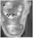 Fig. 01 - SYSTEMS AND METHODS FOR TREATMENT OF A PATIENT INCLUDING RF AND ELECTRICAL ENERGY