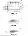 Fig. 02 - Methods and systems for shaping the radiation distribution profile of a protected radiation source used for treating medical conditions