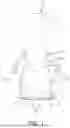 Fig. 02 - BALL JOINT AND VEHICLE HAVING THE SAME