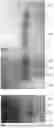Fig. 07 - MODIFIED SHIGELLA APYRASE AND USES THEREOF