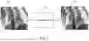 Fig. 02 - SYSTEMS AND METHODS FOR DEBLURRING AND DENOISING MEDICAL IMAGES