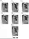 Fig. 06 - EAR INSERT SHAPE DETERMINATION