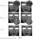 Fig. 07 - SYSTEM FOR IMAGE PROCESSING, A METHOD OF FACIAL EXPRESSION DETECTION AND A METHOD OF RECONSTRUCTION IMAGE GENERATION