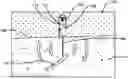 Fig. 01 - Wormer Device