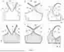 Fig. 02 - BACK TO FRONT REVERSIBLE GARMENT