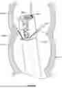Fig. 167 - FLUID DISTRIBUTION DEVICE FOR A MULTIPLE VIEWING ELEMENTS ENDOSCOPE