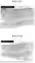 Fig. 13 - Method for high frequency pulse application for cosmetic improvement effect of skin and skin care device using the same
