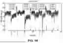 Fig. 13 - Methods and systems for controlling blood pressure by controlling atrial pressure