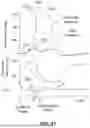 Fig. 14 - Methods and systems for controlling blood pressure by controlling atrial pressure