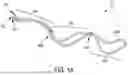 Fig. 02 - Oneband resistance exercise system
