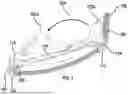 Fig. 04 - REMOVABLE VENTING SHIELD FOR EYEWEAR