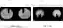 Fig. 06 - SYSTEMS AND METHODS FOR MACHINE VISION CALIBRATION