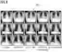 Fig. 08 - CROSS DOMAIN SEGMENTATION WITH UNCERTAINTY-GUIDED CURRICULUM LEARNING