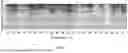 Fig. 06 - Method for Linear Quantitative Dynamic Range Extension