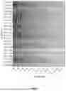 Fig. 08 - Method for Linear Quantitative Dynamic Range Extension